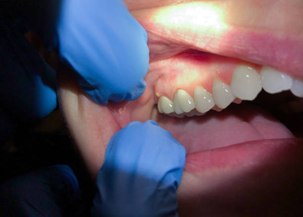 Best Same-Day Emergency Dentist in Pinebluff, NC